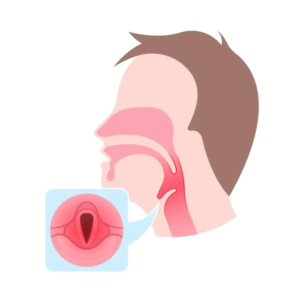 Frequent Difficulty Swallowing: One of the Lesser-Known Signs of Cancer​