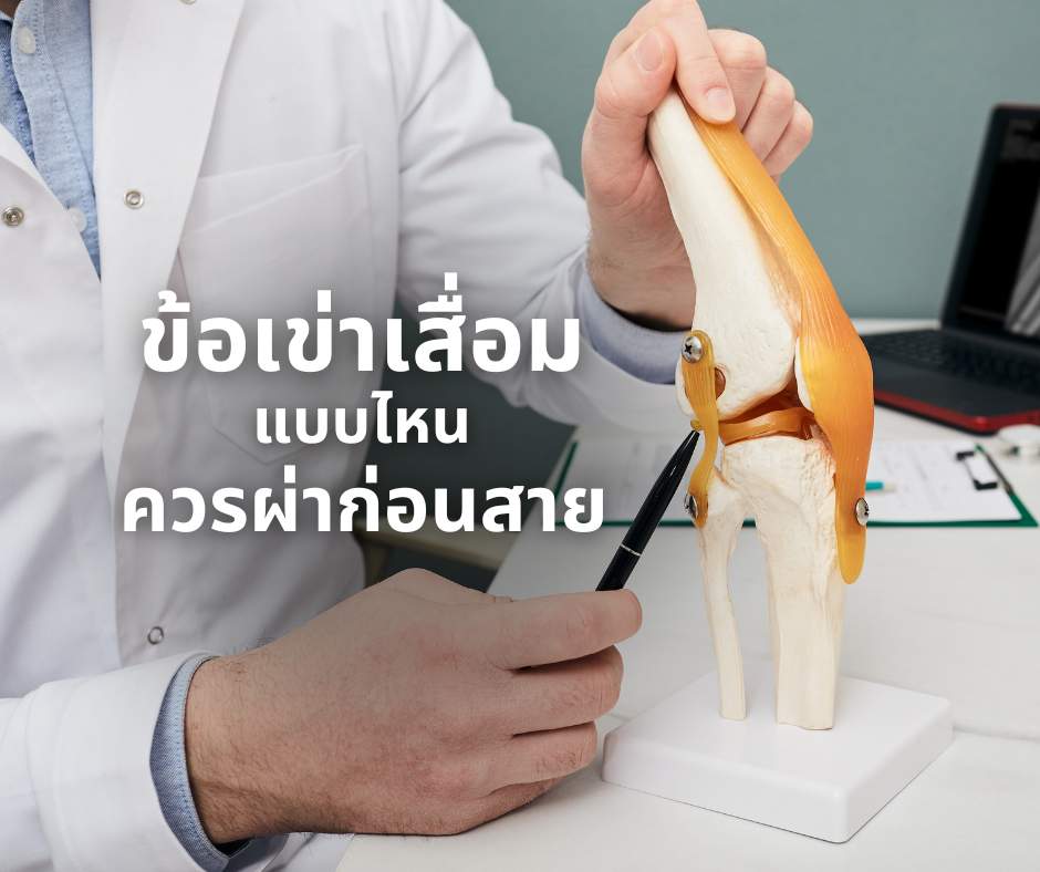 ผ่าข้อเข่า