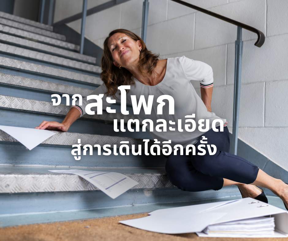 สะโพกแตก